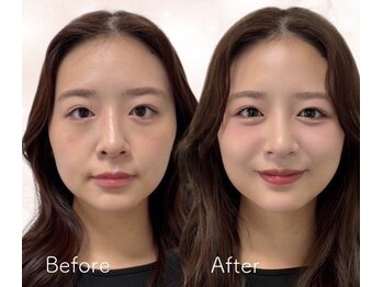 メゾンカラクル