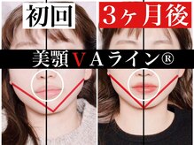 バリンタイ(Bali'n Thai)