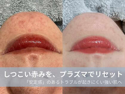 ラシック 加古川店(La chic.)の写真