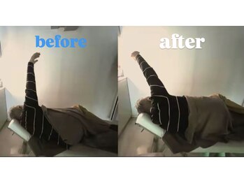 オルド(ORDO)/肩関節可動チェック