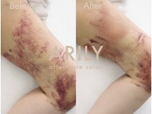 アリリィ(ARILY)/ARILY after care salon