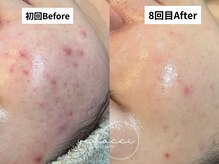 ワイシーハッチ(yc.hacci)