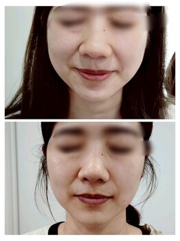 縁(en)の写真/韓国で話題の最新美容《レモンボトル》×エステを超えた《エステポテンツァ》で圧倒的小顔へ♪