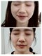 縁(en)の写真/韓国で話題の最新美容《レモンボトル》×エステを超えた《エステポテンツァ》で圧倒的小顔へ♪