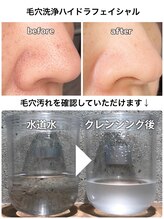 KMB 中崎町店/before　after