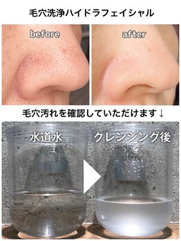 KMB 中崎町店/before　after