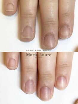 マリーロール 梅田店(Marie Laure)/自爪育成/深爪矯正/ネイルケア