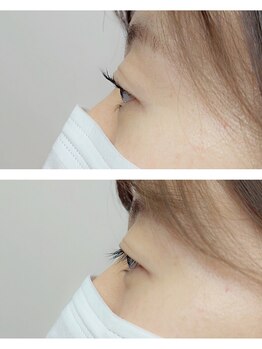 アイラッシュ クレセント(eyelash CRESCENT)/横から見ると～！