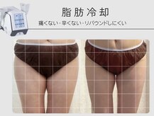コラゾン 酵素風呂 本厚木店
