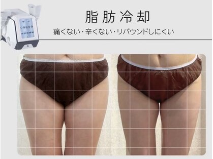 コラゾン 酵素風呂 本厚木店の写真