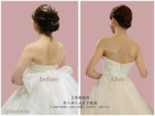 クイーンズ ピュア 恵比寿店(Queen's Pure)/二の腕シェイプ