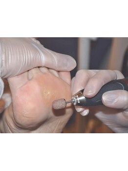 角質ケアができるサロン