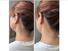 リモレア(RemoLe'a)の雰囲気（即ツルツルの速効性＆持続力が圧倒的【MIX脱毛】）