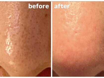 はだなのの写真