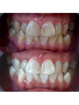 ワールドビューティー(World Beauty)/40代女性/ホワイトニング