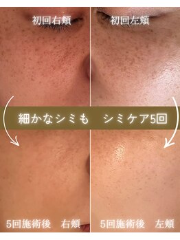 ココロ(COCORO)/継続は力なり