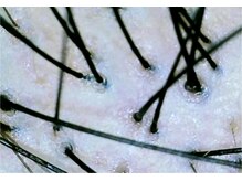 イーズ/リバイタ グランツリー武蔵小杉店/【ケース6】30代女性　before