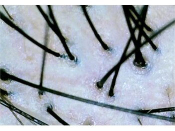 イーズ/リバイタ グランツリー武蔵小杉店/【ケース6】30代女性　before