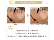 アイル イオン喜連瓜破駅前店/ホワイトスノーピール結果