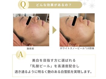 アイル イオン喜連瓜破駅前店/ホワイトスノーピール結果