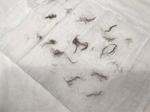 ネルケア(NERUKEA)/【首・襟足・背中脱毛の前】