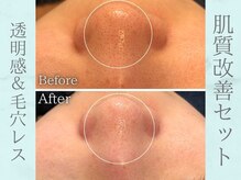 ネオファースト(NeoFirst)/1度で透明感アップ&毛穴レス