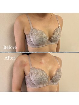 プリマベラ 大阪梅田(primabella)/下着盛れる！バストアップ