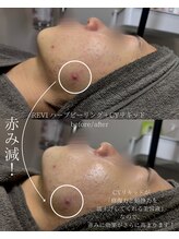 シツ(SHITSU)/CYリキッドの魅力