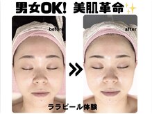 マリア(MALIA)の雰囲気（毛穴・くすみを一掃！速攻ケア毛穴レス透明肌へ最短ルート♪）
