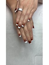 オランダエステティック(Holland Esthetics)/フレンチ