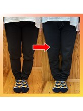 ストレッチヒーロー 東広島店/O脚X脚