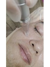 アンジェリーナ/ほったらかしの年齢肌にはこちら