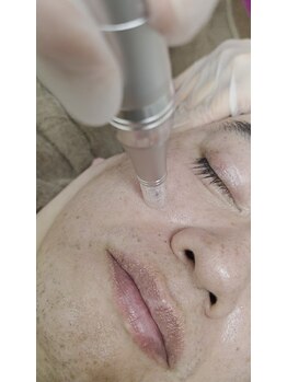 アンジェリーナ/ほったらかしの年齢肌にはこちら