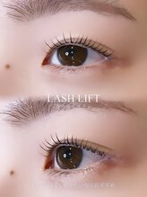 ジッピー オブ トータルビューティー アイエク(Zippy of totalbeauty iEQ)/