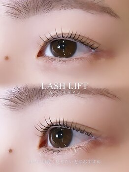 ジッピー オブ トータルビューティー アイエク(Zippy of totalbeauty iEQ)/