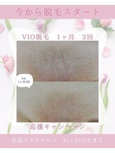RiとBiのたまご