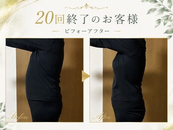 ヨサパーク リリー(YOSA PARK Lily)の写真/【結果重視の最強ダイエット】無理な運動や食事制限はリバウンドの原因に…。脂肪を燃焼出来る身体へ♪