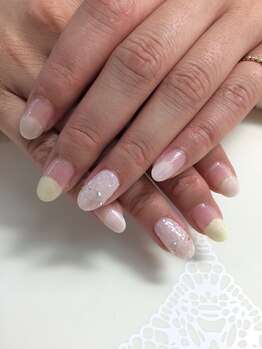 ネイルサロン ティアラリュクス 市川北口店(Tiara Luxe)/イエローネイル