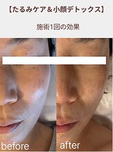 フル(Full)/ハンドテクニックに定評あり♪