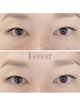 ヴェレスト 西荻窪(Verest)/フラットラッシュ80本