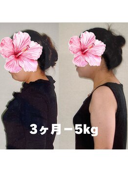 アロハウス(ALOHOUSE)/顔もちいさくかわいくなった！