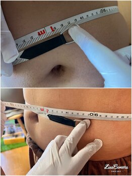 ヒーリングリゾート ナゴミ(Nagomi)/【脂肪冷却】