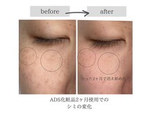 リノン(Rinon)の雰囲気（本格肌改善プログラムあり！深刻なお悩みも対応いたします。）