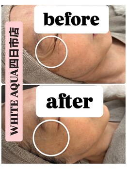 ホワイトアクア 四日市店(WHITE AQUA)/ララピール5回目のお客様