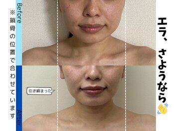 お顔の研究所/ビフォーアフター写真♪