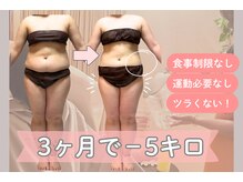 ヨサパーク 美 キレイ(YOSA PARK 美 Kirei)