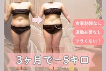 ヨサパーク 美 キレイ(YOSA PARK 美 Kirei)