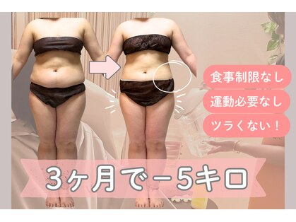 ヨサパーク 美 キレイ(YOSA PARK 美 Kirei)の写真