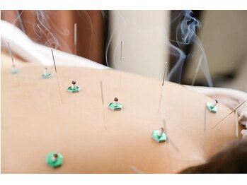 神谷澤鍼灸整骨院/鍼灸/はりきゅう