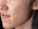 美意識の写真/【毛穴・赤ニキビも同時にケア！明るい素肌美を】ホームケアでは叶わない透明感溢れる艶肌へ！